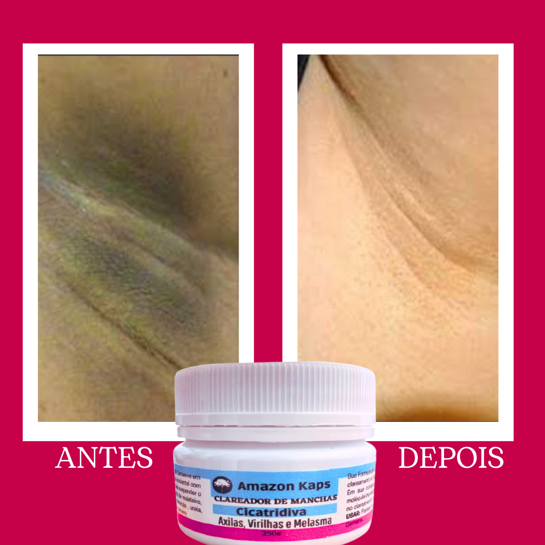 ANTES-6.png