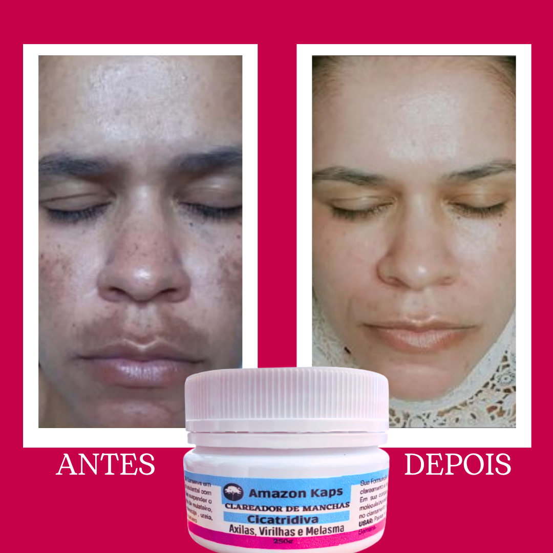 ANTES-7.png